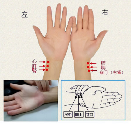 中医把脉手法图解左手心肝肾，右手肺脾命门。(图1)
